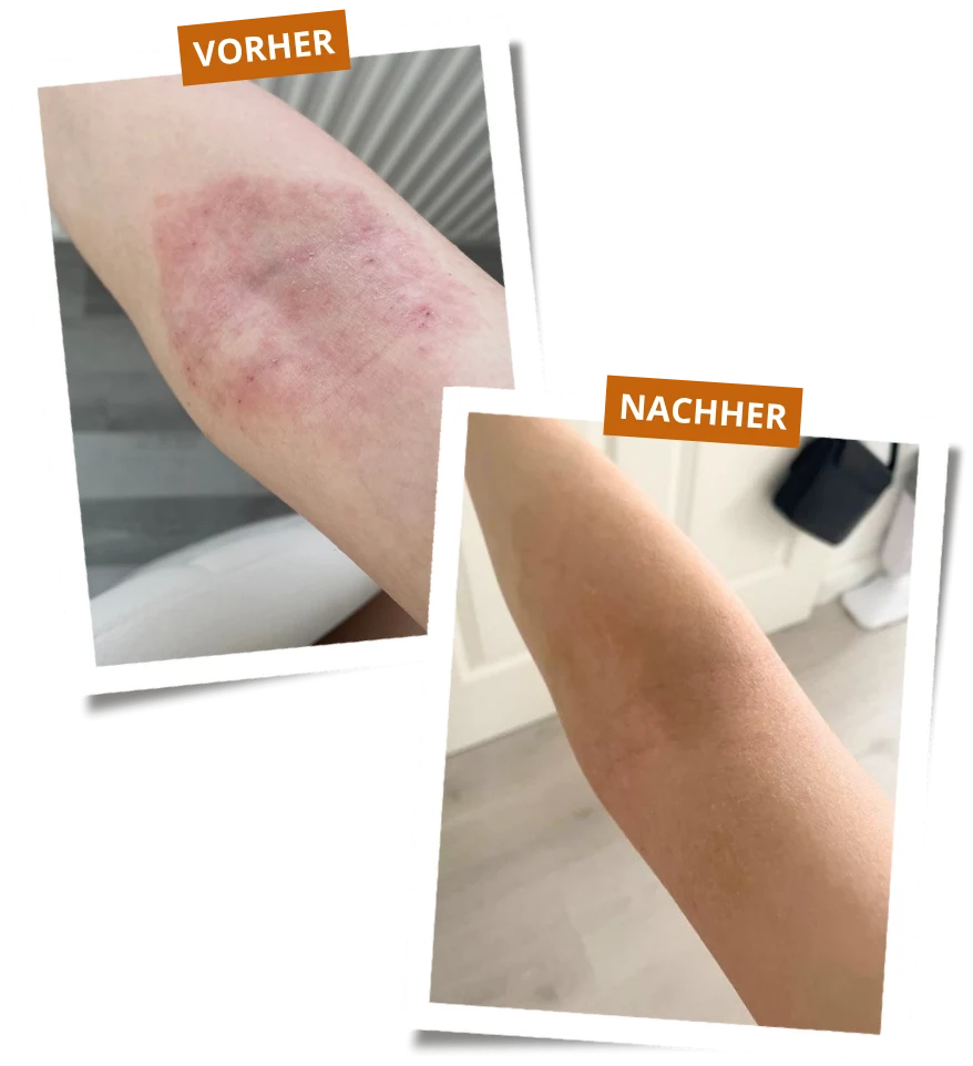 Vorher-Nachher-Ergebnis einer Klientin