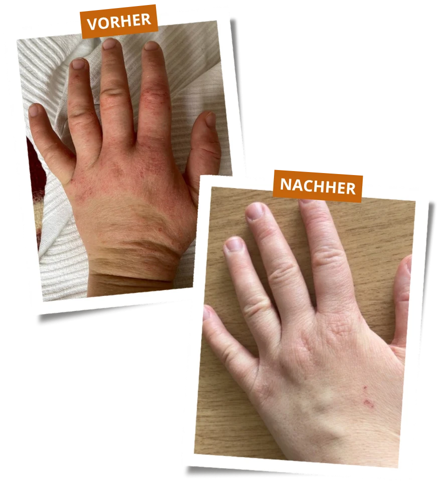 Vorher-Nachher-Ergebnis einer Klientin